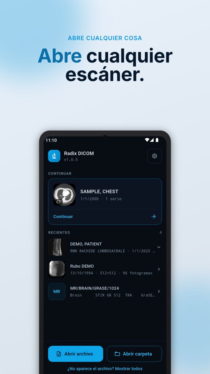 Pantalla de inicio de Radix DICOM con las pruebas abiertas recientemente y los botones Abrir archivo y Abrir carpeta