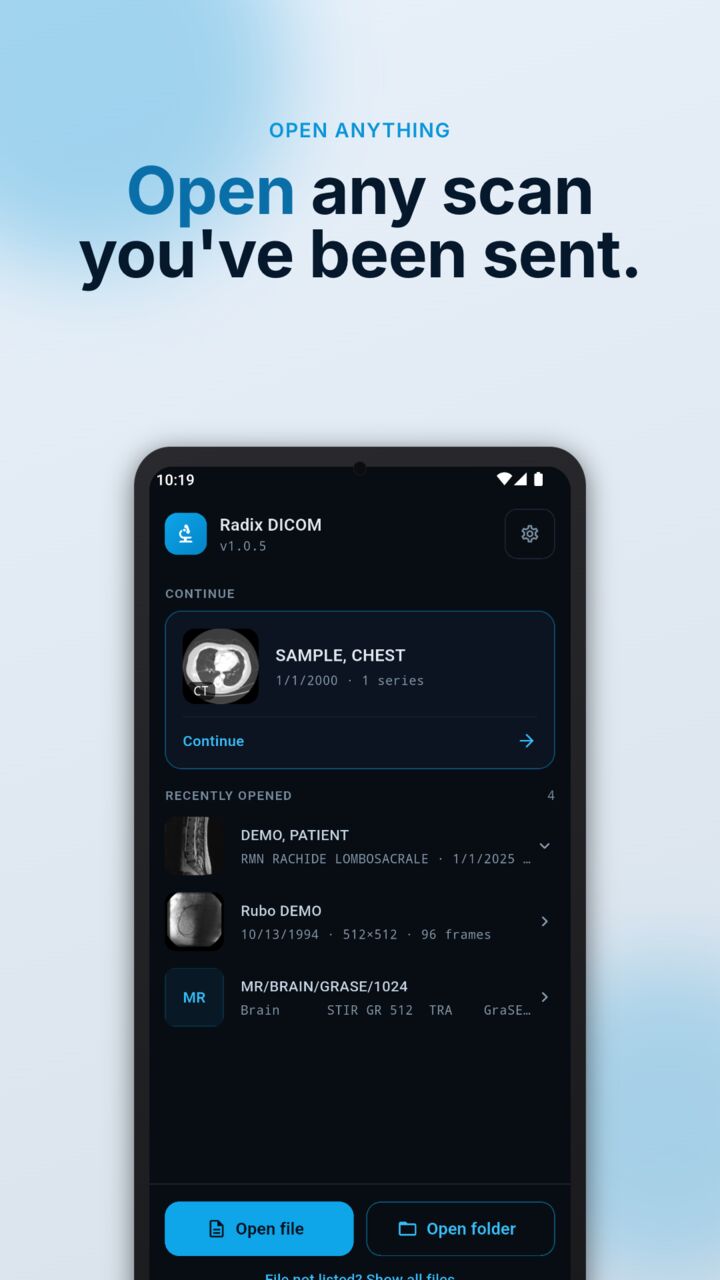 Radix DICOM home screen listing recently opened scans, with Open file and Open folder buttons